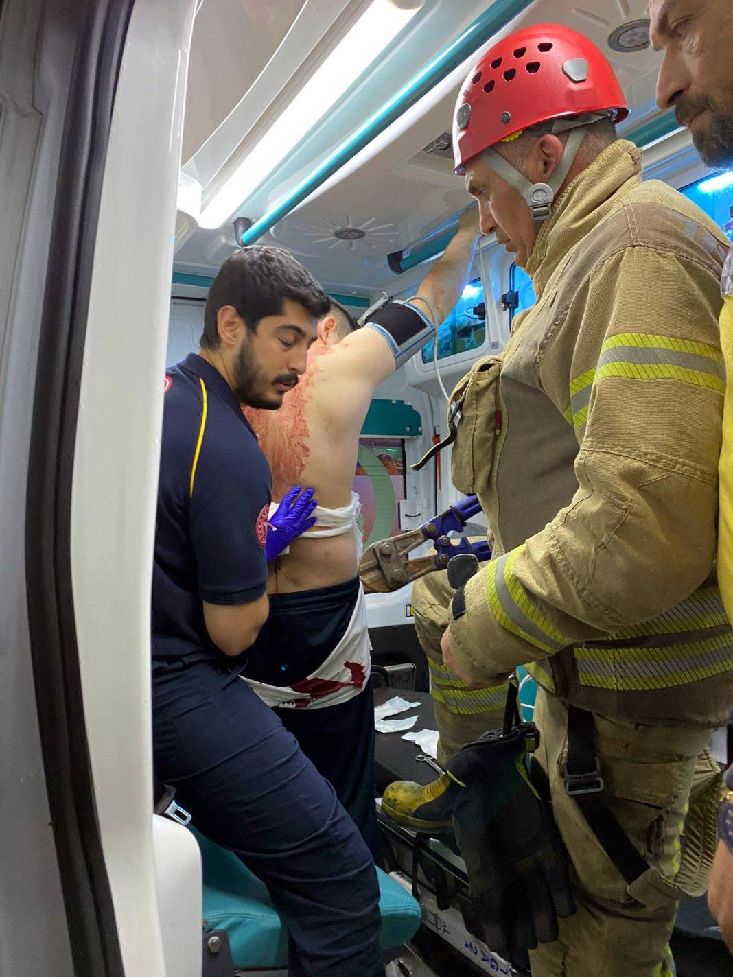 3 yıl önce zıpkınla yaralanmıştı, bu kez silahlı saldırıda öldü 4